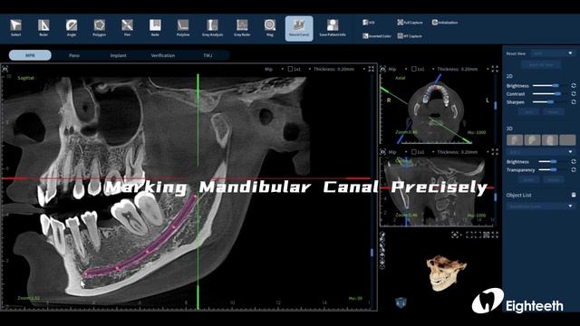 Демонстрация программы FINSCAN F350: кадр из видео